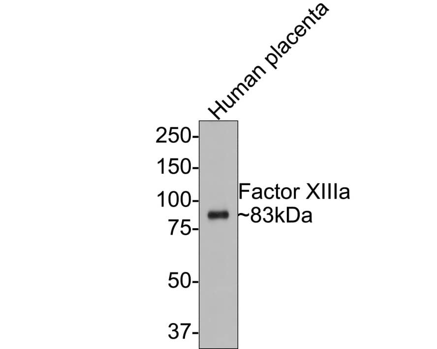 Western blot analysis of  human placenta tissue lysates with NBP3-32326 at 1/500 dilution. Lysates/proteins at 20 µg/Lane. Predicted band size: 83 kDa Observed band size: 83 kDa Exposure time: 2 minutes; 8% SDS-PAGE gel. Proteins were transferred to a PVDF membrane and blocked with 5% NFDM/TBST for 1 hour at room temperature. NBP3-32326 at 1/500 dilution was used in 5% NFDM/TBST at room temperature for 2 hours. Goat Anti-Rabbit IgG [HRP] Secondary Antibody at 1:300,000 dilution was used for 1 hour at room temperature.