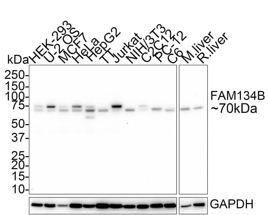 Western blot analysis on different lysates with NBP3-32330 at 1/1,000 dilution. Lane 1: HEK-293 cell lysate (30 µg/Lane) Lane 2: U-2 OS cell lysate (30 µg/Lane) Lane 3: MCF7 cell lysate (30 µg/Lane) Lane 4: HeLa cell lysate (30 µg/Lane) Lane 5: HepG2 cell lysate (30 µg/Lane) Lane 6: TT cell lysate (30 µg/Lane) Lane 7: Jurkat cell lysate (30 µg/Lane) Lane 8: NIH/3T3 cell lysate (30 µg/Lane) Lane 9: C2C12 cell lysate (30 µg/Lane) Lane 10: PC-12 cell lysate (30 µg/Lane) Lane 11: C6 cell lysate (30 µg/Lane) Lane 12: Mouse liver tissue lysate (30 µg/Lane) Lane 13: Rat liver tissue lysate (30 µg/Lane) Predicted band size: 55 kDa Observed band size: 70 kDa Exposure time: 6 minutes 20 seconds; 4-20% SDS-PAGE gel. Proteins were transferred to a PVDF membrane and blocked with 5% NFDM/TBST for 1 hour at room temperature. NBP3-32330 at 1/1,000 dilution was used in 5% NFDM/TBST at 4℃ overnight. Goat Anti-Rabbit IgG [HRP] Secondary Antibody at 1/50,000 dilution was used for 1 hour at room temperature.