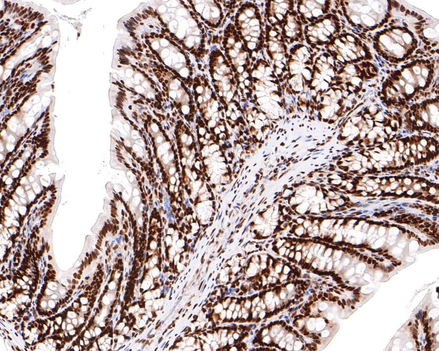 Immunohistochemistry: FAM50A Antibody (JE65-21) [NBP3-32332] - Immunohistochemical analysis of paraffin-embedded rat rectum tissue with Rabbit anti-FAM50A antibody (NBP3-32332) at 1/400 dilution. The section was pre-treated using heat mediated antigen retrieval with sodium citrate buffer (pH 6.0) for 2 minutes. The tissues were blocked in 1% BSA for 20 minutes at room temperature, washed with ddH2O and PBS, and then probed with the primary antibody (NBP3-32332) at 1/400 dilution for 1 hour at room temperature. The detection was performed using an HRP conjugated compact polymer system. DAB was used as the chromogen. Tissues were counterstained with hematoxylin and mounted with DPX.
