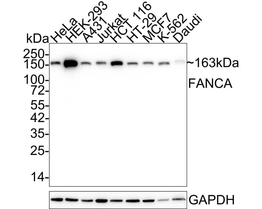 Western Blot: FACA/FANCA Antibody (JE36-22) [NBP3-32333] - Western blot analysis of FACA/FANCA on different lysates with Rabbit anti-FACA/FANCA antibody (NBP3-32333) at 1/1,000 dilution. Lane 1: HeLa cell lysate Lane 2: HEK-293 cell lysate Lane 3: A431 cell lysate Lane 4: Jurkat cell lysate Lane 5: HCT 116 cell lysate Lane 6: HT-29 cell lysate Lane 7: MCF7 cell lysate Lane 8: K-562 cell lysate Lane 9: Daudi cell lysate Lysates/proteins at 20 ug/Lane. Predicted band size: 163 kDa Observed band size: 163 kDa Exposure time: 1 minute 59 seconds; 4-20% SDS-PAGE gel. Proteins were transferred to a PVDF membrane and blocked with 5% NFDM/TBST for 1 hour at room temperature. The primary antibody (NBP3-32333) at 1/1,000 dilution was used in 5% NFDM/TBST at 4C overnight. Goat Anti-Rabbit IgG - HRP Secondary Antibody at 1/50,000 dilution was used for 1 hour at room temperature.