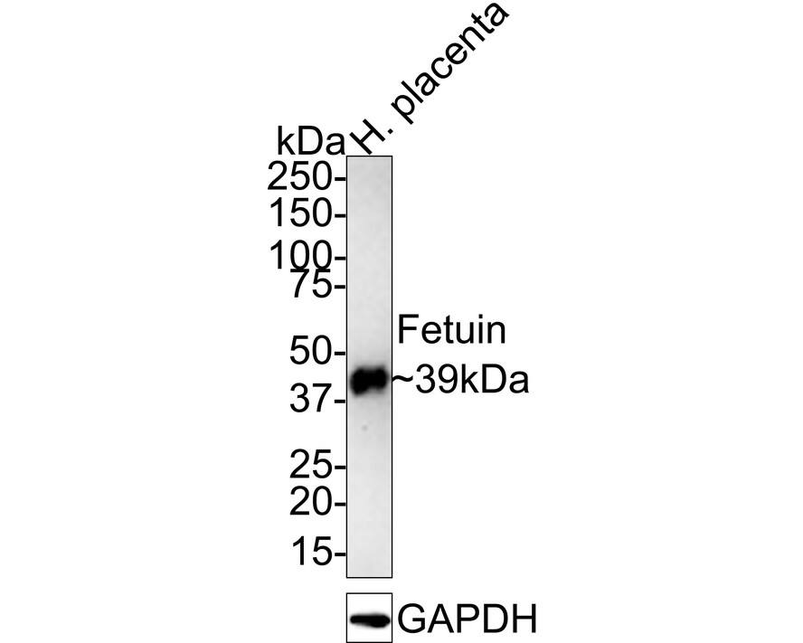 Western Blot: Fetuin A/AHSG Antibody (JE54-96) [NBP3-32336] - Western blot analysis of Fetuin A/AHSG on human placenta tissue lysates with Rabbit anti-Fetuin A/AHSG antibody (NBP3-32336) at 1/1,000 dilution. Lysates/proteins at 20 ug/Lane. Predicted band size: 39 kDa Observed band size: 39 kDa Exposure time: 5 minutes 30 seconds; 4-20% SDS-PAGE gel. Proteins were transferred to a PVDF membrane and blocked with 5% NFDM/TBST for 1 hour at room temperature. The primary antibody (NBP3-32336) at 1/1,000 dilution was used in 5% NFDM/TBST at room temperature for 2 hours. Goat Anti-Rabbit IgG - HRP Secondary Antibody at 1:100,000 dilution was used for 1 hour at room temperature.