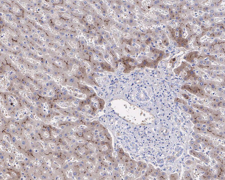 Immunohistochemistry: Fetuin A/AHSG Antibody (JE54-96) [NBP3-32336] - Immunohistochemical analysis of paraffin-embedded human liver tissue with Rabbit anti-Fetuin A/AHSG antibody (NBP3-32336) at 1/1,000 dilution. The section was pre-treated using heat mediated antigen retrieval with Tris-EDTA buffer (pH 9.0) for 20 minutes. The tissues were blocked in 1% BSA for 20 minutes at room temperature, washed with ddH2O and PBS, and then probed with the primary antibody (NBP3-32336) at 1/1,000 dilution for 1 hour at room temperature. The detection was performed using an HRP conjugated compact polymer system. DAB was used as the chromogen. Tissues were counterstained with hematoxylin and mounted with DPX.