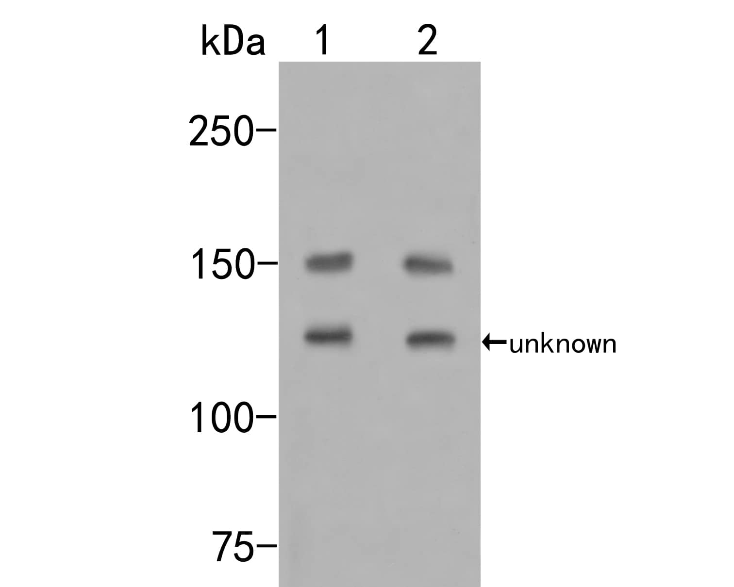 Western Blot: Flightless I Antibody [NBP3-32341] - Western blot analysis of Flightless I on different lysates. Proteins were transferred to a PVDF membrane and blocked with 5% NFDM/TBST for 1 hour at room temperature. The primary antibody (NBP3-32341, 1/500) was used in 5% NFDM/TBST at room temperature for 2 hours. Goat Anti-Rabbit IgG - HRP Secondary Antibody at 1:200,000 dilution was used for 1 hour at room temperature. Positive control:  Lane 1: Mouse lung tissue lysate Lane 2: MCF-7 cell lysate