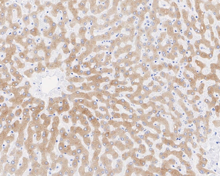 Immunohistochemistry: FMO3 Antibody (JE55-13) [NBP3-32344] - Immunohistochemical analysis of paraffin-embedded human liver tissue with Rabbit anti-FMO3 antibody (NBP3-32344) at 1/2,000 dilution. The section was pre-treated using heat mediated antigen retrieval with Tris-EDTA buffer (pH 9.0) for 20 minutes. The tissues were blocked in 1% BSA for 20 minutes at room temperature, washed with ddH2O and PBS, and then probed with the primary antibody (NBP3-32344) at 1/2,000 dilution for 1 hour at room temperature. The detection was performed using an HRP conjugated compact polymer system. DAB was used as the chromogen. Tissues were counterstained with hematoxylin and mounted with DPX.