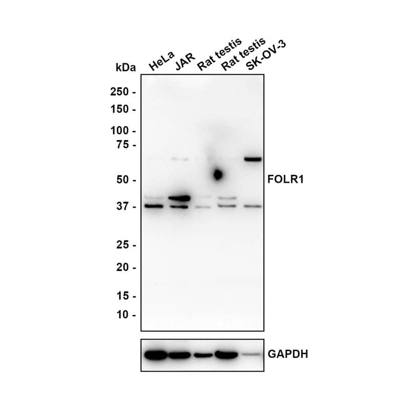 Western blot analysis on different lysates with NBP3-32345 at 1/1,000 dilution. Lane 1: HeLa cell lysate (20 µg/Lane) Lane 2: JAR cell lysate (20 µg/Lane) Lane 3: Rat testis tissue lysate (40 µg/Lane) Lane 4: A549 cell lysate (20 µg/Lane) Lane 5: SK-OV-3 cell lysate (20 µg/Lane) Predicted band size: 30 kDa Observed band size: 37~70 kDa Exposure time: 2 minutes 37 seconds; 4-20% SDS-PAGE gel. Proteins were transferred to a PVDF membrane and blocked with 5% NFDM/TBST for 1 hour at room temperature. NBP3-32345 at 1/1,000 dilution was used in 5% NFDM/TBST at room temperature for 2 hours. Goat Anti-Rabbit IgG [HRP] Secondary Antibody at 1:100,000 dilution was used for 1 hour at room temperature.