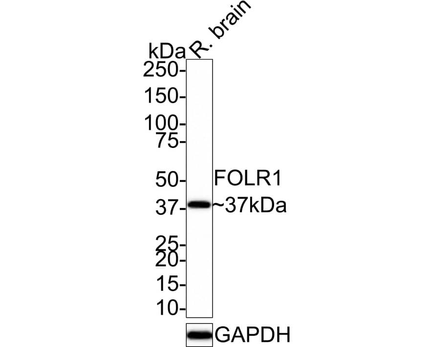 Western blot analysis of  rat brain tissue lysates with NBP3-32345 at 1/1,000 dilution. Lysates/proteins at 20 µg/Lane. Predicted band size: 30 kDa Observed band size: 37 kDa Exposure time: 3 minutes; 4-20% SDS-PAGE gel. Proteins were transferred to a PVDF membrane and blocked with 5% NFDM/TBST for 1 hour at room temperature. NBP3-32345 at 1/1,000 dilution was used in 5% NFDM/TBST at room temperature for 2 hours. Goat Anti-Rabbit IgG [HRP] Secondary Antibody at 1:100,000 dilution was used for 1 hour at room temperature.