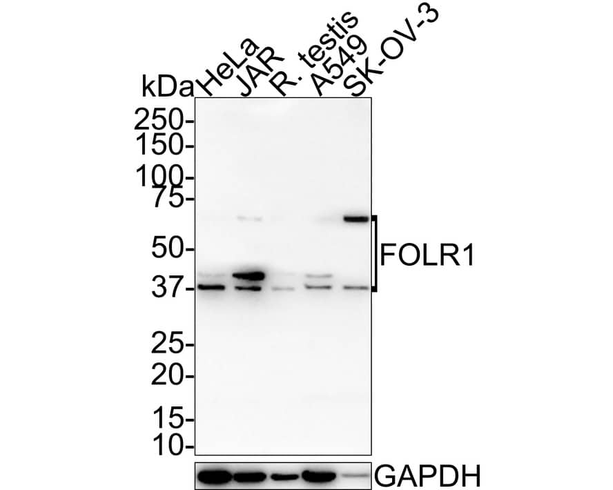 Western Blot: FOLR1 Antibody (JE31-40) [NBP3-32345] - Western blot analysis of FOLR1 on different lysates with Rabbit anti-FOLR1 antibody (NBP3-32345) at 1/1,000 dilution. Lane 1: HeLa cell lysate (20 ug/Lane) Lane 2: JAR cell lysate (20 ug/Lane) Lane 3: Rat testis tissue lysate (40 ug/Lane) Lane 4: A549 cell lysate (20 ug/Lane) Lane 5: SK-OV-3 cell lysate (20 ug/Lane) Predicted band size: 30 kDa Observed band size: 37~70 kDa Exposure time: 2 minutes 37 seconds; 4-20% SDS-PAGE gel. Proteins were transferred to a PVDF membrane and blocked with 5% NFDM/TBST for 1 hour at room temperature. The primary antibody (NBP3-32345) at 1/1,000 dilution was used in 5% NFDM/TBST at room temperature for 2 hours. Goat Anti-Rabbit IgG - HRP Secondary Antibody at 1:100,000 dilution was used for 1 hour at room temperature.