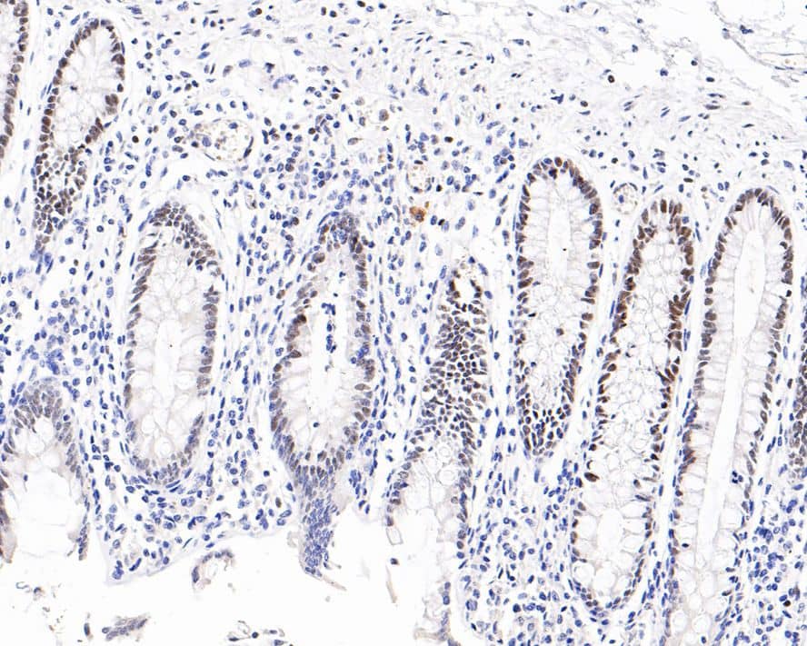 Immunohistochemistry: FoxP1 Antibody (PD00-47) [NBP3-32349] - Immunohistochemical analysis of paraffin-embedded human colon tissue with Rabbit anti-FoxP1 antibody (NBP3-32349) at 1/1,000 dilution. The section was pre-treated using heat mediated antigen retrieval with sodium citrate buffer (pH 6.0) for 2 minutes. The tissues were blocked in 1% BSA for 20 minutes at room temperature, washed with ddH2O and PBS, and then probed with the primary antibody (NBP3-32349) at 1/1,000 dilution for 1 hour at room temperature. The detection was performed using an HRP conjugated compact polymer system. DAB was used as the chromogen. Tissues were counterstained with hematoxylin and mounted with DPX.