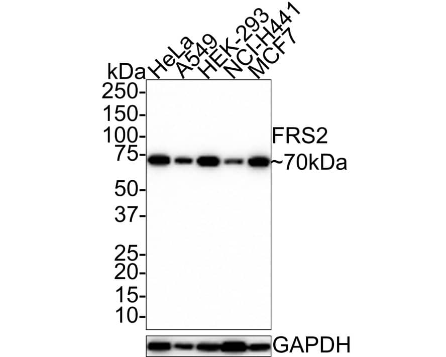 Western Blot: FRS2 Antibody (JE30-77) [NBP3-32351] - Western blot analysis of FRS2 on different lysates with Rabbit anti-FRS2 antibody (NBP3-32351) at 1/1,000 dilution. Lane 1: HeLa cell lysate Lane 2: A549 cell lysate Lane 3: HEK-293 cell lysate Lane 4: NCI-H441 cell lysate Lane 5: MCF7 cell lysate Lysates/proteins at 20 ug/Lane. Predicted band size: 57 kDa Observed band size: 70 kDa Exposure time: 20 seconds; 4-20% SDS-PAGE gel. Proteins were transferred to a PVDF membrane and blocked with 5% NFDM/TBST for 1 hour at room temperature. The primary antibody (NBP3-32351) at 1/1,000 dilution was used in 5% NFDM/TBST at room temperature for 2 hours. Goat Anti-Rabbit IgG - HRP Secondary Antibody at 1:100,000 dilution was used for 1 hour at room temperature.