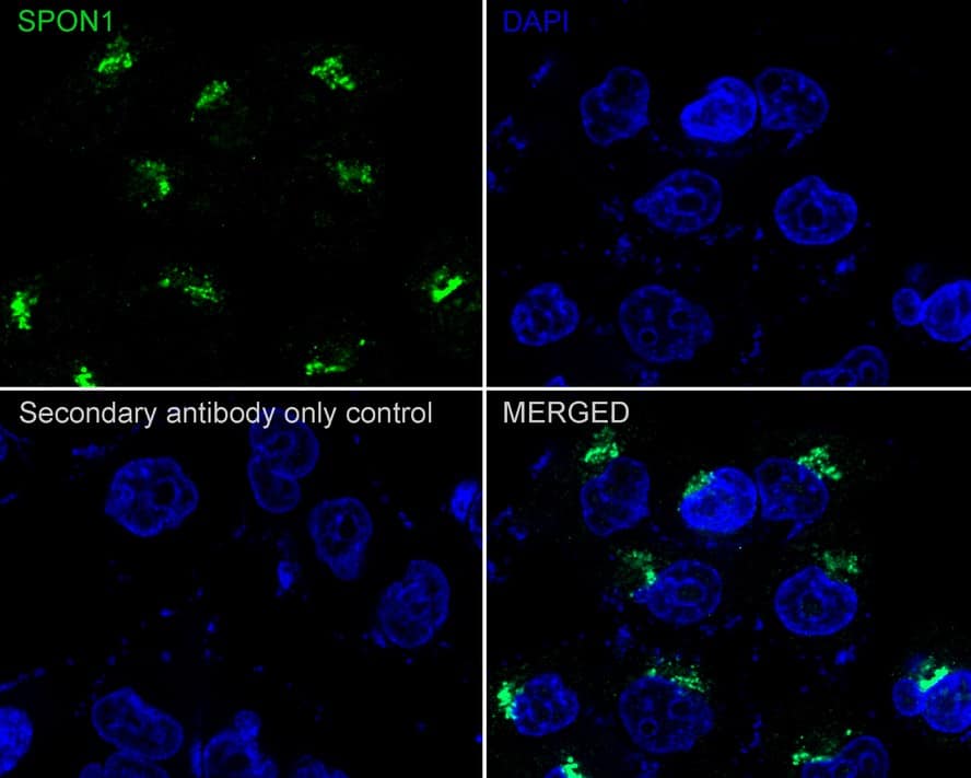 Immunocytochemistry/ Immunofluorescence: F-Spondin/SPON1 Antibody (PSH02-84) [NBP3-32352] - Immunocytochemistry analysis of PANC-1 cells labeling F-Spondin/SPON1 with Rabbit anti-F-Spondin/SPON1 antibody (NBP3-32352) at 1/500 dilution. Cells were fixed in 4% paraformaldehyde for 20 minutes at room temperature, permeabilized with 0.1% Triton X-100 in PBS for 5 minutes at room temperature, then blocked with 1% BSA in 10% negative goat serum for 1 hour at room temperature. Cells were then incubated with Rabbit anti-F-Spondin/SPON1 antibody (NBP3-32352) at 1/500 dilution in 1% BSA in PBST overnight at 4 ℃. Goat Anti-Rabbit IgG H&L (iFluor™ 488) was used as the secondary antibody at 1/1,000 dilution. PBS instead of the primary antibody was used as the secondary antibody only control. Nuclear DNA was labelled in blue with DAPI.