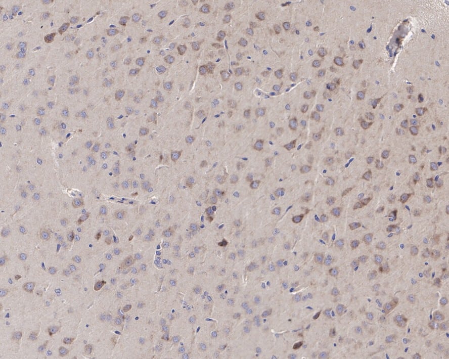 Immunohistochemistry: FUNDC1 Antibody (PSH0-92) [NBP3-32353] - Immunohistochemical analysis of paraffin-embedded rat brain tissue with Rabbit anti-FUNDC1 antibody (NBP3-32353) at 1/50 dilution. The section was pre-treated using heat mediated antigen retrieval with Tris-EDTA buffer (pH 9.0) for 20 minutes. The tissues were blocked in 1% BSA for 20 minutes at room temperature, washed with ddH2O and PBS, and then probed with the primary antibody (NBP3-32353) at 1/50 dilution for 1 hour at room temperature. The detection was performed using an HRP conjugated compact polymer system. DAB was used as the chromogen. Tissues were counterstained with hematoxylin and mounted with DPX.