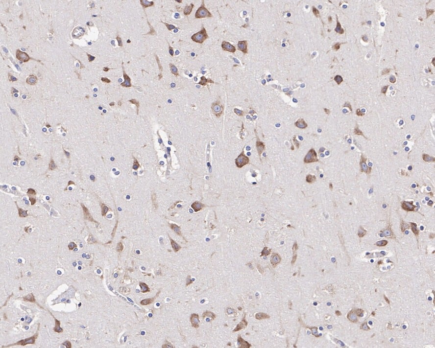 Immunohistochemistry: FXR1 Antibody (JE40-57) [NBP3-32354] - Immunohistochemical analysis of paraffin-embedded human brain tissue with Rabbit anti-FXR1 antibody (NBP3-32354) at 1/1,000 dilution. The section was pre-treated using heat mediated antigen retrieval with Tris-EDTA buffer (pH 9.0) for 20 minutes. The tissues were blocked in 1% BSA for 20 minutes at room temperature, washed with ddH2O and PBS, and then probed with the primary antibody (NBP3-32354) at 1/1,000 dilution for 1 hour at room temperature. The detection was performed using an HRP conjugated compact polymer system. DAB was used as the chromogen. Tissues were counterstained with hematoxylin and mounted with DPX.