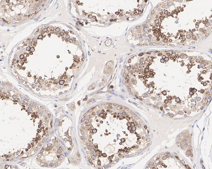 Immunohistochemistry: FXR1 Antibody (PSH01-35) [NBP3-32355] - Immunohistochemical analysis of paraffin-embedded human testis tissue with Rabbit anti-FXR1 antibody (NBP3-32355) at 1/200 dilution. The section was pre-treated using heat mediated antigen retrieval with Tris-EDTA buffer (pH 9.0) for 20 minutes. The tissues were blocked in 1% BSA for 20 minutes at room temperature, washed with ddH2O and PBS, and then probed with the primary antibody (NBP3-32355) at 1/200 dilution for 1 hour at room temperature. The detection was performed using an HRP conjugated compact polymer system. DAB was used as the chromogen. Tissues were counterstained with hematoxylin and mounted with DPX.