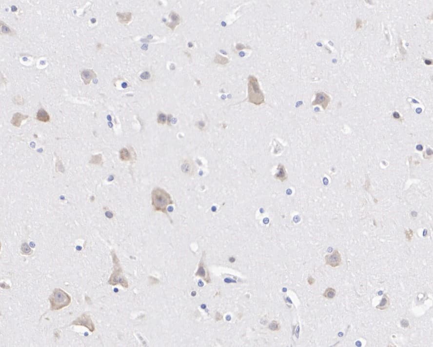 Immunohistochemistry: FXR1 Antibody (PSH01-67) [NBP3-32356] - Immunohistochemical analysis of paraffin-embedded human brain tissue with Rabbit anti-FXR1 antibody (NBP3-32356) at 1/1,000 dilution. The section was pre-treated using heat mediated antigen retrieval with Tris-EDTA buffer (pH 9.0) for 20 minutes. The tissues were blocked in 1% BSA for 20 minutes at room temperature, washed with ddH2O and PBS, and then probed with the primary antibody (NBP3-32356) at 1/1,000 dilution for 1 hour at room temperature. The detection was performed using an HRP conjugated compact polymer system. DAB was used as the chromogen. Tissues were counterstained with hematoxylin and mounted with DPX.