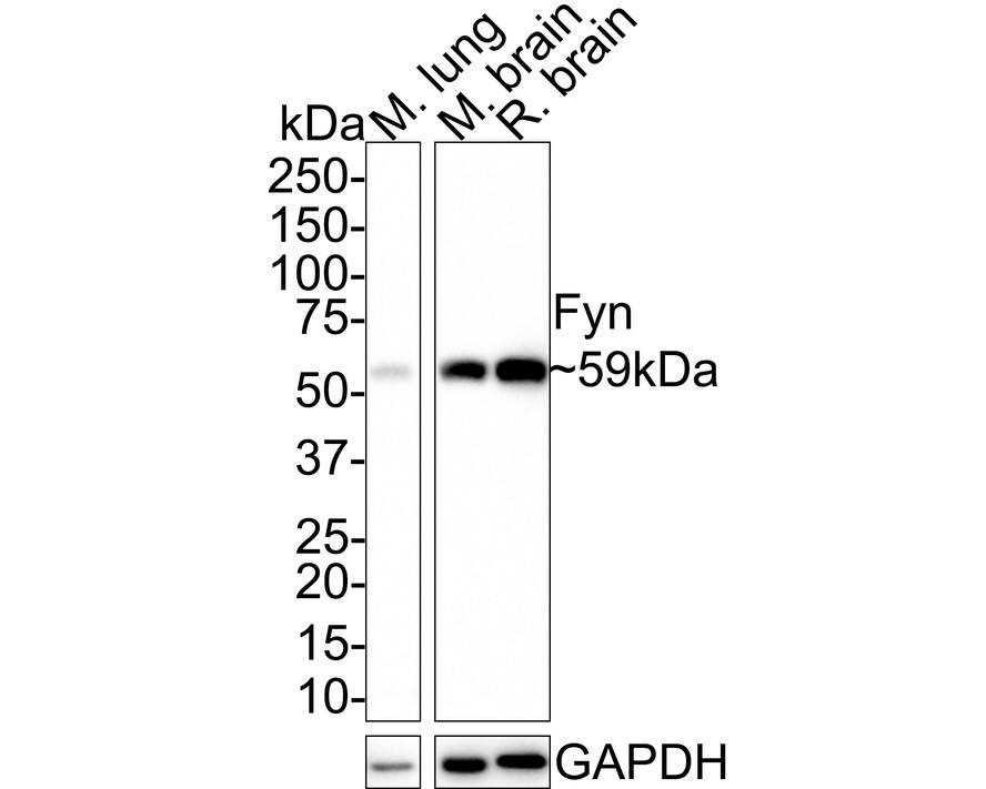 Western blot analysis on different lysates with NBP3-32357 at 1/1,000 dilution. Lane 1: Mouse lung tissue lysate Lane 2: Mouse brain tissue lysate Lane 3: Rat brain tissue lysate Lysates/proteins at 40 µg/Lane. Predicted band size: 61 kDa Observed band size: 59 kDa Exposure time: 3 minutes; 4-20% SDS-PAGE gel. Proteins were transferred to a PVDF membrane and blocked with 5% NFDM/TBST for 1 hour at room temperature. NBP3-32357 at 1/1,000 dilution was used in 5% NFDM/TBST at room temperature for 2 hours. Goat Anti-Rabbit IgG [HRP] Secondary Antibody at 1:100,000 dilution was used for 1 hour at room temperature.