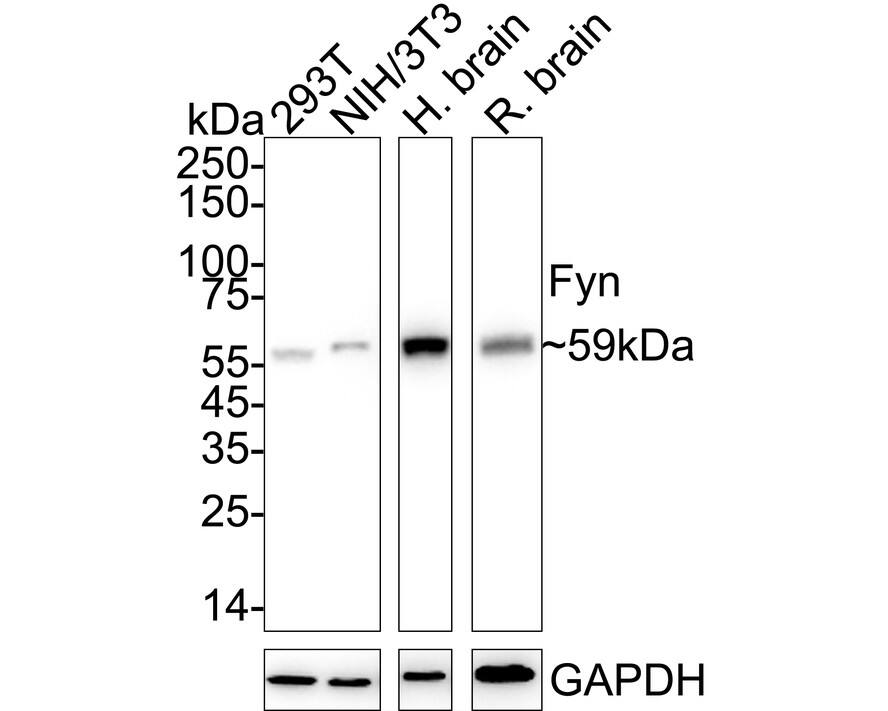 Western blot analysis on different lysates with NBP3-32357 at 1/1,000 dilution. Lane 1: 293T cell lysate (20 µg/Lane) Lane 2: NIH/3T3 cell lysate (20 µg/Lane) Lane 3: Human brain tissue lysate (40 µg/Lane) Lane 4: Rat brain tissue lysate (40 µg/Lane) Predicted band size: 61 kDa Observed band size: 59 kDa Exposure time: Lane 1-2: 3 minutes; Lane 3-4: 14 seconds;  4-20% SDS-PAGE gel. Proteins were transferred to a PVDF membrane and blocked with 5% NFDM/TBST for 1 hour at room temperature. NBP3-32357 at 1/1,000 dilution was used in 5% NFDM/TBST at 4℃ overnight. Goat Anti-Rabbit IgG [HRP] Secondary Antibody at 1/50,000 dilution was used for 1 hour at room temperature.