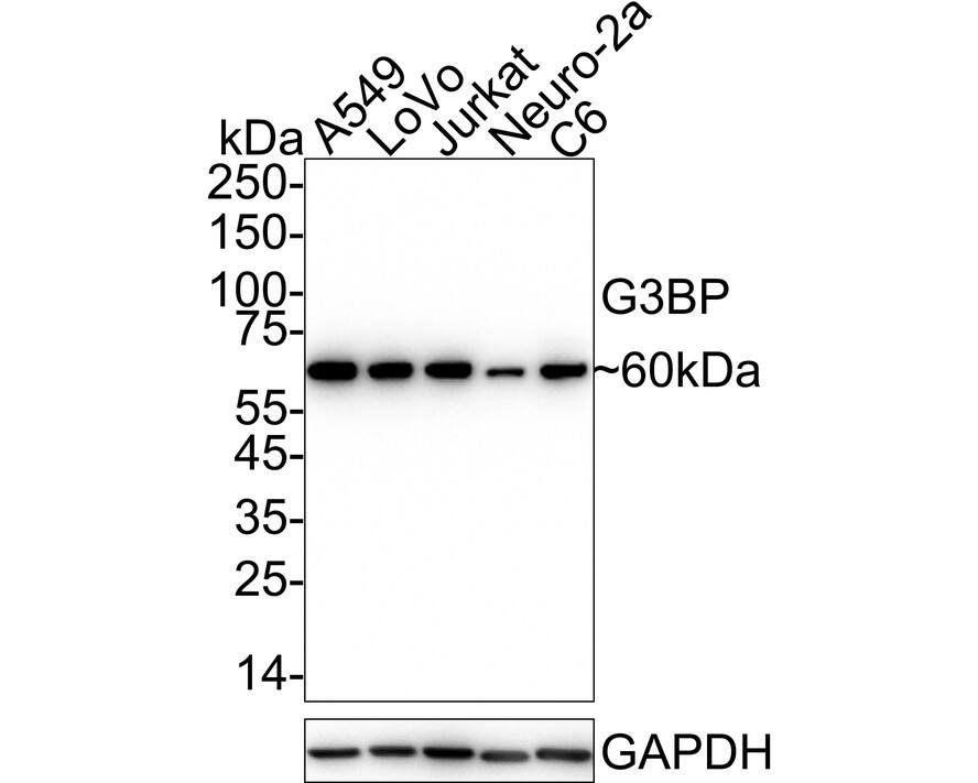 Western blot analysis on different lysates with NBP3-32358 at 1/1,000 dilution. Lane 1: A549 cell lysate (20 µg/Lane) Lane 2: LoVo cell lysate (20 µg/Lane) Lane 3: Jurkat cell lysate (20 µg/Lane) Lane 4: Neuro-2a cell lysate (20 µg/Lane) Lane 5: C6 cell lysate (20 µg/Lane) Predicted band size: 52 kDa Observed band size: 60 kDa Exposure time: 20 seconds;  4-20% SDS-PAGE gel. Proteins were transferred to a PVDF membrane and blocked with 5% NFDM/TBST for 1 hour at room temperature. NBP3-32358 at 1/1,000 dilution was used in 5% NFDM/TBST at 4℃ overnight. Goat Anti-Rabbit IgG [HRP] Secondary Antibody at 1/50,000 dilution was used for 1 hour at room temperature.