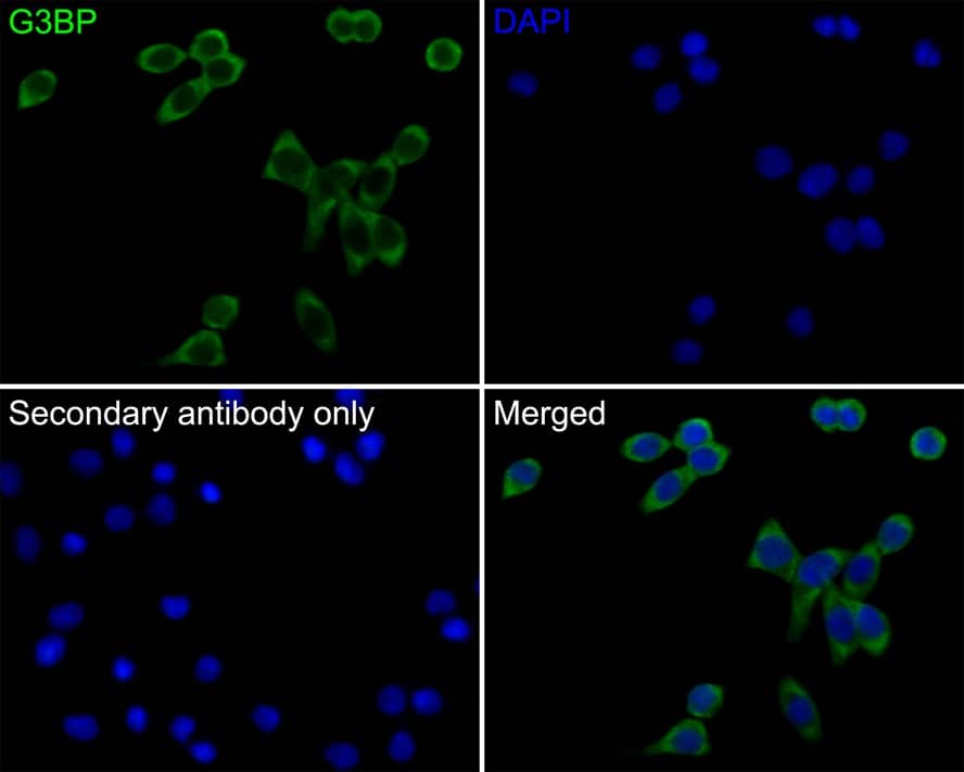 Immunocytochemistry/ Immunofluorescence: G3BP1 Antibody (JE35-20) [NBP3-32358] - Immunocytochemistry analysis of LOVO cells labeling G3BP1 with Rabbit anti-G3BP11 antibody (NBP3-32358) at 1/50 dilution. Cells were fixed in 4% paraformaldehyde for 10 minutes at 37 ℃, permeabilized with 0.05% Triton X-100 in PBS for 20 minutes, and then blocked with 2% negative goat serum for 30 minutes at room temperature. Cells were then incubated with Rabbit anti-G3BP1 antibody (NBP3-32358) at 1/50 dilution in 2% negative goat serum overnight at 4 ℃. Goat Anti-Rabbit IgG H&L (iFluor™ 488) was used as the secondary antibody at 1/1,000 dilution. PBS instead of the primary antibody was used as the secondary antibody only control. Nuclear DNA was labelled in blue with DAPI.