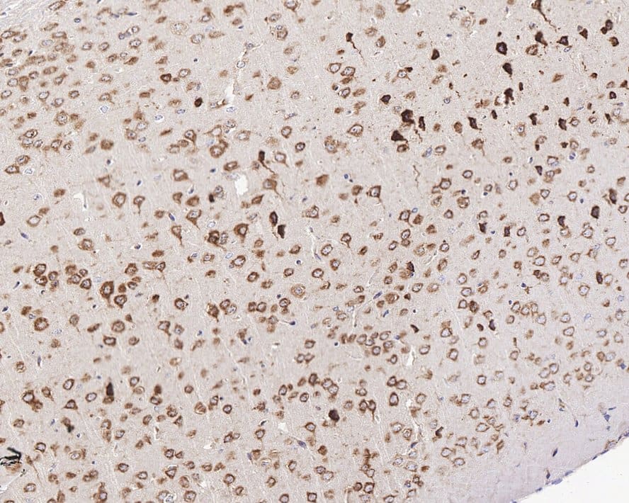 Immunohistochemistry: GABA-B R1 Antibody (JE60-09) [NBP3-32359] - Immunohistochemical analysis of paraffin-embedded mouse brain tissue with Rabbit anti-GABA-B R1 antibody (NBP3-32359) at 1/1,000 dilution. The section was pre-treated using heat mediated antigen retrieval with Tris-EDTA buffer (pH 9.0) for 20 minutes. The tissues were blocked in 1% BSA for 20 minutes at room temperature, washed with ddH2O and PBS, and then probed with the primary antibody (NBP3-32359) at 1/1,000 dilution for 1 hour at room temperature. The detection was performed using an HRP conjugated compact polymer system. DAB was used as the chromogen. Tissues were counterstained with hematoxylin and mounted with DPX.