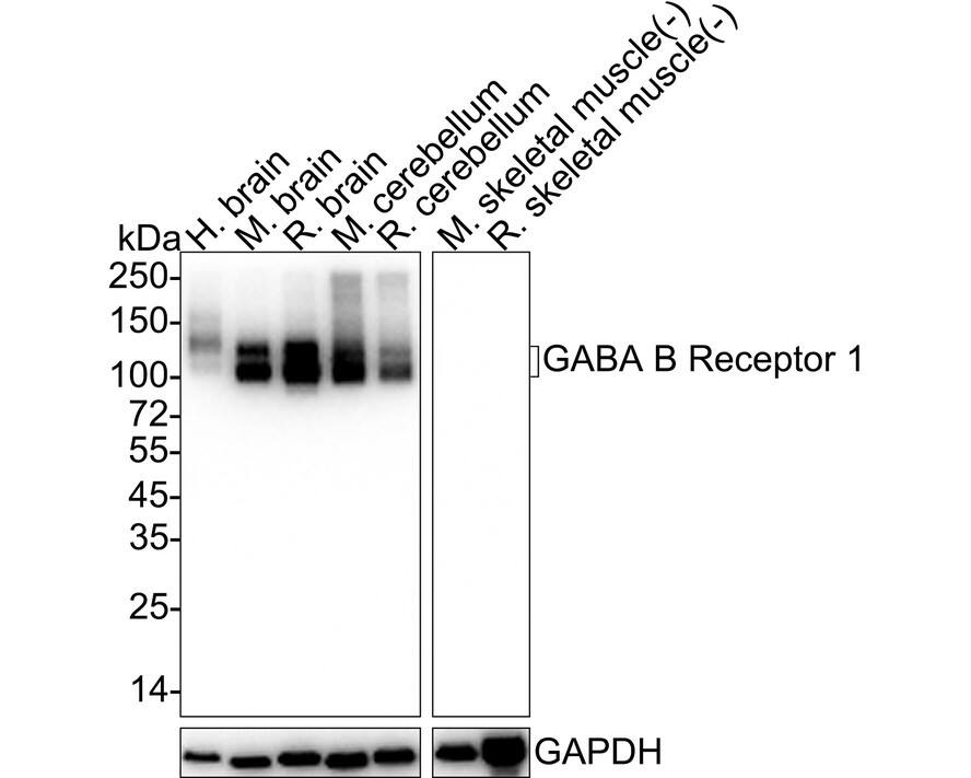 Western blot analysis on different lysates with NBP3-32360 at 1/5,000 dilution. Lane 1: Human brain tissue lysate (40 µg/Lane) Lane 2: Mouse brain tissue lysate (no heat) (20 µg/Lane) Lane 3: Rat brain tissue lysate (no heat) (20 µg/Lane) Lane 4: Mouse cerebellum tissue lysate (70℃ heat) (20 µg/Lane) Lane 5: Rat cerebellum tissue lysate (20 µg/Lane) Lane 6: Mouse skeletal muscle tissue lysate (no heat) (negative) (20 µg/Lane) Lane 7: Rat skeletal muscle tissue lysate (no heat) (negative) (20 µg/Lane) Notice: no heat means the lysate is not boiled. Predicted band size: 108 kDa Observed band size: 95-108 kDa Exposure time: 4 seconds;  4-20% SDS-PAGE gel. Proteins were transferred to a PVDF membrane and blocked with 5% NFDM/TBST for 1 hour at room temperature. NBP3-32360 at 1/5,000 dilution was used in 5% NFDM/TBST at 4℃ overnight. Goat Anti-Rabbit IgG [HRP] Secondary Antibody at 1/50,000 dilution was used for 1 hour at room temperature.