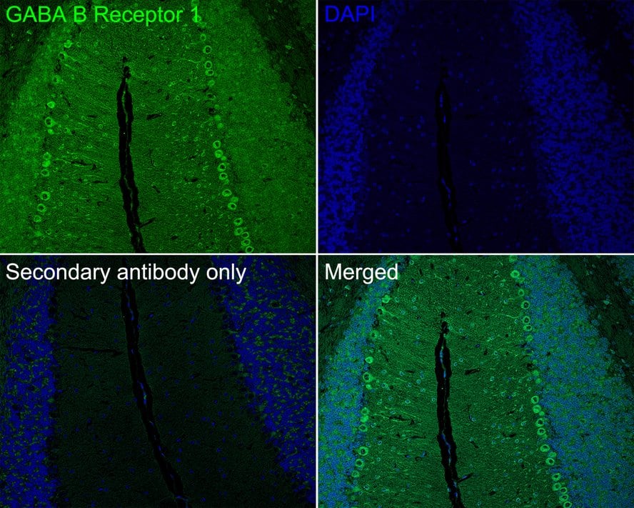 Immunohistochemistry: GABA-B R1 Antibody (PSH03-87) [NBP3-32360] - Immunofluorescence analysis of paraffin-embedded mouse cerebellum tissue labeling GABA-B R1 with Rabbit anti-GABA-B R1 antibody (NBP3-32360) at 1/50 dilution. The section was pre-treated using heat mediated antigen retrieval with Tris-EDTA buffer (pH 9.0) for 20 minutes. The tissues were blocked in 10% negative goat serum for 1 hour at room temperature, washed with PBS, and then probed with the primary antibody (NBP3-32360, green) at 1/50 dilution overnight at 4 ℃, washed with PBS. Goat Anti-Rabbit IgG H&L (iFluor™ 488) was used as the secondary antibody at 1/1,000 dilution. Nuclei were counterstained with DAPI (blue).