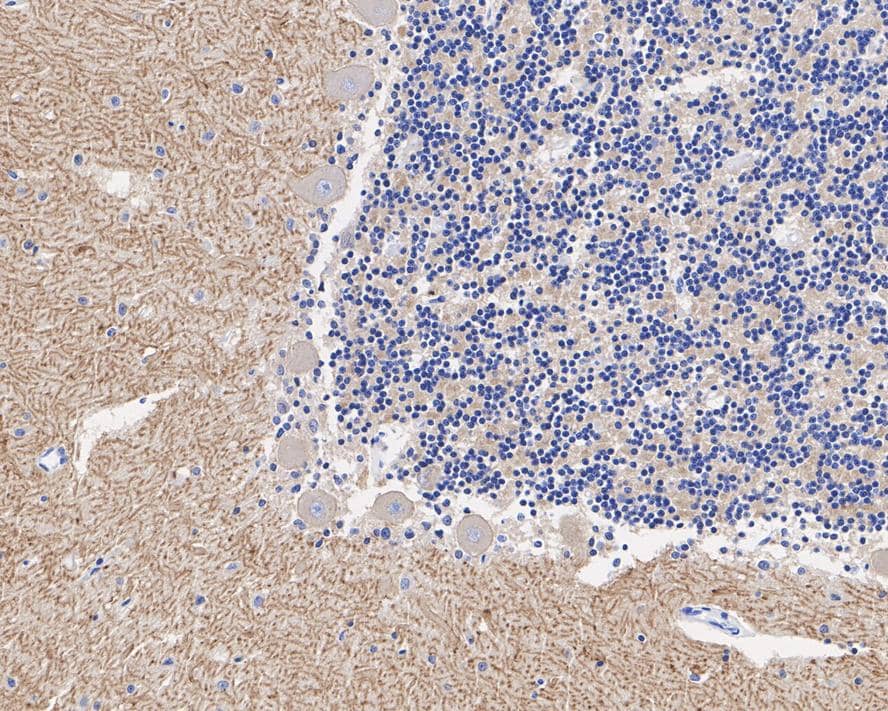 Immunohistochemistry: GABA-B R1 Antibody (PSH03-87) [NBP3-32360] - Immunohistochemical analysis of paraffin-embedded human cerebellum tissue with Rabbit anti-GABA-B R1 antibody (NBP3-32360) at 1/20,000 dilution. The section was pre-treated using heat mediated antigen retrieval with Tris-EDTA buffer (pH 9.0) for 20 minutes. The tissues were blocked in 1% BSA for 20 minutes at room temperature, washed with ddH2O and PBS, and then probed with the primary antibody (NBP3-32360) at 1/20,000 dilution for 1 hour at room temperature. The detection was performed using an HRP conjugated compact polymer system. DAB was used as the chromogen. Tissues were counterstained with hematoxylin and mounted with DPX.