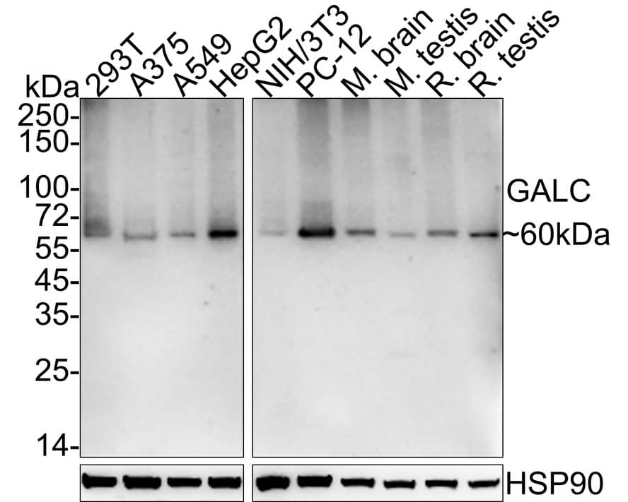 Western Blot Galactosylceramidase/GALC Antibody (PSH03-45)
