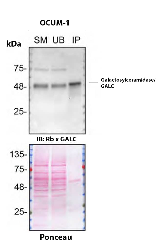 OCUM-1 cell line lysates were prepared and immunoprecipitation was performed using 2.0 μg of Galactosylceramidase/GALC Antibody (PSH03-45) (Catalog # NBP3-32361) pre-coupled to Dynabeads Protein A. Immunoprecipitated Galactosylceramidase/GALC was detected in Western Blot with a rabbit Galactosylceramidase/GALC antibody used at 1/1000. The Ponceau stained transfer of the blot is shown. SM=4% starting material; UB=4% unbound fraction; IP=immunoprecipitate; HC=antibody heavy chain. Image, protocol and testing courtesy of YCharOS Inc. (ycharos.com).