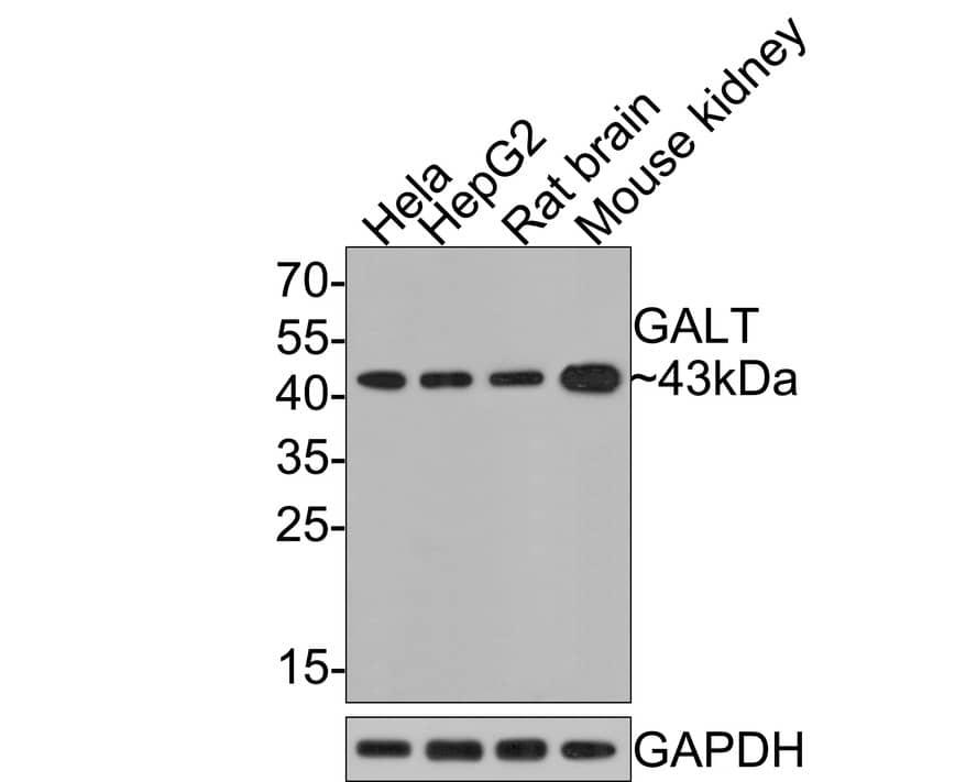 Western Blot: GALT Antibody (JE64-66) [NBP3-32362] - Western blot analysis of GALT on different lysates with Rabbit anti-GALT antibody (NBP3-32362) at 1/500 dilution. Lane 1: Hela cell lysate (10 ug/Lane) Lane 2: HepG2 cell lysate (10 ug/Lane) Lane 3: Rat brain tissue lysate (20 ug/Lane) Lane 4: Mouse kidney tissue lysate (20 ug/Lane) Predicted band size: 43 kDa Observed band size: 43 kDa Exposure time: 2 minutes; 12% SDS-PAGE gel. Proteins were transferred to a PVDF membrane and blocked with 5% NFDM/TBST for 1 hour at room temperature. The primary antibody (NBP3-32362) at 1/500 dilution was used in 5% NFDM/TBST at room temperature for 2 hours. Goat Anti-Rabbit IgG - HRP Secondary Antibody at 1:300,000 dilution was used for 1 hour at room temperature.