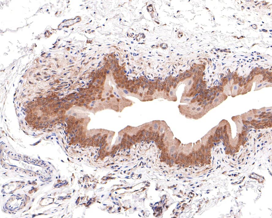 Immunohistochemistry: GALT Antibody (JE64-66) [NBP3-32362] - Immunohistochemical analysis of paraffin-embedded rat bladder tissue with Rabbit anti-GALT antibody (NBP3-32362) at 1/100 dilution. The section was pre-treated using heat mediated antigen retrieval with Tris-EDTA buffer (pH 9.0) for 20 minutes. The tissues were blocked in 1% BSA for 20 minutes at room temperature, washed with ddH2O and PBS, and then probed with the primary antibody (NBP3-32362) at 1/100 dilution for 1 hour at room temperature. The detection was performed using an HRP conjugated compact polymer system. DAB was used as the chromogen. Tissues were counterstained with hematoxylin and mounted with DPX.