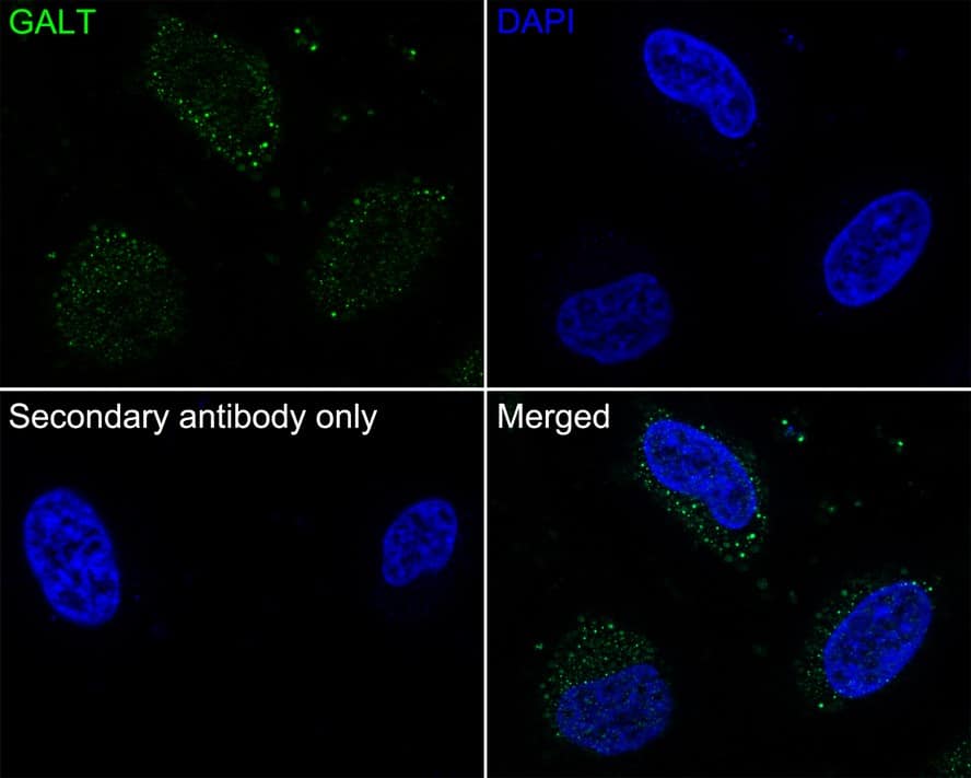 Immunocytochemistry/ Immunofluorescence: GALT Antibody (PSH02-87) [NBP3-32363] - Immunocytochemistry analysis of HeLa cells labeling GALT with Rabbit anti-GALT antibody (NBP3-32363) at 1/100 dilution. Cells were fixed in 4% paraformaldehyde for 20 minutes at room temperature, permeabilized with 0.1% Triton X-100 in PBS for 5 minutes at room temperature, then blocked with 1% BSA in 10% negative goat serum for 1 hour at room temperature. Cells were then incubated with Rabbit anti-GALT antibody (NBP3-32363) at 1/100 dilution in 1% BSA in PBST overnight at 4 ℃. Goat Anti-Rabbit IgG H&L (iFluor™ 488) was used as the secondary antibody at 1/1,000 dilution. PBS instead of the primary antibody was used as the secondary antibody only control. Nuclear DNA was labelled in blue with DAPI.