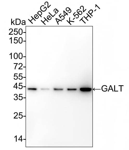 Western blot analysis on different lysates with NBP3-32364 at 1/5,000 dilution and competitor's antibody at 1/2,000 dilution. Lane 1: HepG2 cell lysate (15 µg/Lane) Lane 2: HeLa cell lysate (15 µg/Lane) Lane 3: A549 cell lysate (15 µg/Lane) Lane 4: K-562 cell lysate (15 µg/Lane) Lane 5: THP-1 cell lysate (15 µg/Lane) Predicted band size: 43 kDa Observed band size: 43 kDa Exposure time: Lane 1-5 (left): 1 minute 34 seconds;  Exposure time: Lane 1-5 (right): 3 minutes; 4-20% SDS-PAGE gel. Proteins were transferred to a PVDF membrane and blocked with 5% NFDM/TBST for 1 hour at room temperature. NBP3-32364 at 1/5,000 dilution and competitor's antibody at 1/2,000 dilution were used in 5% NFDM/TBST at 4℃ overnight. Goat Anti-Rabbit IgG [HRP] Secondary Antibody at 1/50,000 dilution was used for 1 hour at room temperature.