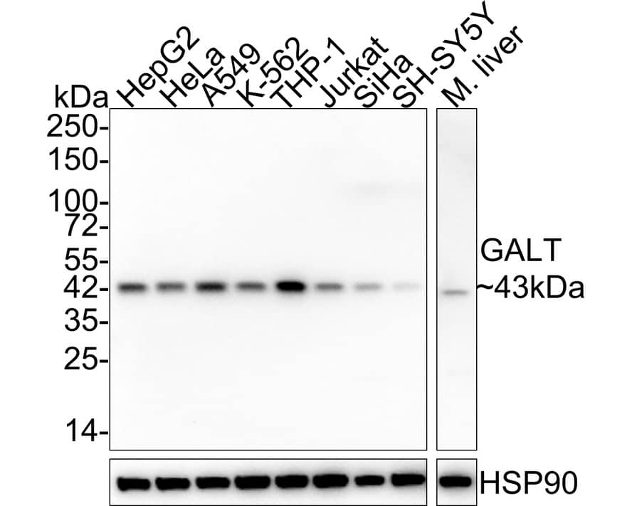 Western blot analysis on different lysates with NBP3-32364 at 1/2,000 dilution. Lane 1: HepG2 cell lysate (20 µg/Lane) Lane 2: HeLa cell lysate (20 µg/Lane) Lane 3: A549 cell lysate (20 µg/Lane) Lane 4: K-562 cell lysate (20 µg/Lane) Lane 5: THP-1 cell lysate (20 µg/Lane) Lane 6: Jurkat cell lysate (20 µg/Lane) Lane 7: SiHa cell lysate (20 µg/Lane) Lane 8: SH-SY5Y cell lysate (20 µg/Lane) Lane 9: Mouse liver tissue lysate (40 µg/Lane) Predicted band size: 43 kDa Observed band size: 43 kDa Exposure time: 43 seconds; 4-20% SDS-PAGE gel. Proteins were transferred to a PVDF membrane and blocked with 5% NFDM/TBST for 1 hour at room temperature. NBP3-32364 at 1/2,000 dilution was used in 5% NFDM/TBST at 4℃ overnight. Goat Anti-Rabbit IgG [HRP] Secondary Antibody at 1/50,000 dilution was used for 1 hour at room temperature.