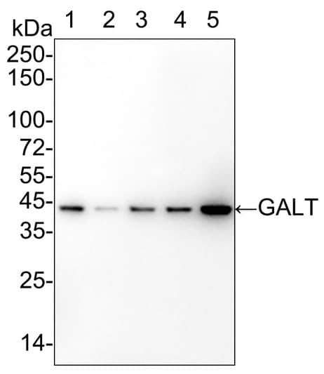 Western Blot: GALT Antibody (PSH02-88) [NBP3-32364] - Western blot analysis of GALT on different lysates with Rabbit anti-GALT antibody (NBP3-32364) at 1/5,000 dilution. Lane 1: HepG2 cell lysate (15 µg/Lane) Lane 2: HeLa cell lysate (15 µg/Lane) Lane 3: A549 cell lysate (15 µg/Lane) Lane 4: K-562 cell lysate (15 µg/Lane) Lane 5: THP-1 cell lysate (15 µg/Lane) Predicted band size: 43 kDa Observed band size: 43 kDa Exposure time:  Lane 1-5 (left): 1 minute 34 seconds;  Lane 1-5 (right): 3 minutes; 4-20% SDS-PAGE gel. Proteins were transferred to a PVDF membrane and blocked with 5% NFDM/TBST for 1 hour at room temperature. The primary antibody at 1/5,000 dilution was used in 5% NFDM/TBST at 4℃ overnight. Goat Anti-Rabbit IgG - HRP Secondary Antibody at 1/50,000 dilution was used for 1 hour at room temperature.