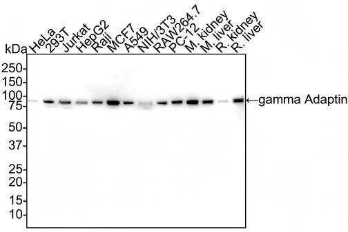 Western blot analysis on different lysates with NBP3-32365 at 1/1,000 dilution and competitor's antibody at 1/1,000 dilution. Lane 1: HeLa cell lysate (20 µg/Lane) Lane 2: 293T cell lysate (20 µg/Lane) Lane 3: Jurkat cell lysate (20 µg/Lane) Lane 4: HepG2 cell lysate (20 µg/Lane) Lane 5: Raji cell lysate (20 µg/Lane) Lane 6: MCF7 cell lysate (20 µg/Lane) Lane 7: A549 cell lysate (20 µg/Lane) Lane 8: NIH/3T3 cell lysate (20 µg/Lane) Lane 9: RAW264.7 cell lysate (20 µg/Lane) Lane 10: PC-12 cell lysate (20 µg/Lane) Lane 11: Mouse kidney tissue lysate (40 µg/Lane) Lane 12: Mouse liver tissue lysate (40 µg/Lane) Lane 13: Rat kidney tissue lysate (40 µg/Lane) Lane 14: Rat liver tissue lysate (40 µg/Lane) Predicted band size: 91 kDa Observed band size: 91 kDa Exposure time: 1 minute 46 seconds; 4-20% SDS-PAGE gel. Proteins were transferred to a PVDF membrane and blocked with 5% NFDM/TBST for 1 hour at room temperature. NBP3-32365 at 1/1,000 dilution and competitor's antibody at 1/1,000 dilution were used in 5% NFDM/TBST at 4℃ overnight. Goat Anti-Rabbit IgG [HRP] Secondary Antibody at 1/50,000 dilution was used for 1 hour at room temperature.