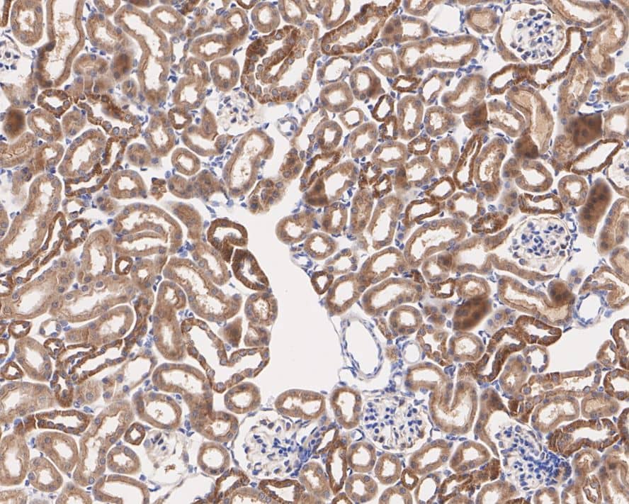 Immunohistochemistry: Gamma Adaptin Antibody (PSH02-65) [NBP3-32365] - Immunohistochemical analysis of paraffin-embedded mouse kidney tissue with Rabbit anti-Gamma Adaptin antibody (NBP3-32365) at 1/200 dilution. The section was pre-treated using heat mediated antigen retrieval with Tris-EDTA buffer (pH 9.0) for 20 minutes. The tissues were blocked in 1% BSA for 20 minutes at room temperature, washed with ddH2O and PBS, and then probed with the primary antibody (NBP3-32365) at 1/200 dilution for 1 hour at room temperature. The detection was performed using an HRP conjugated compact polymer system. DAB was used as the chromogen. Tissues were counterstained with hematoxylin and mounted with DPX.