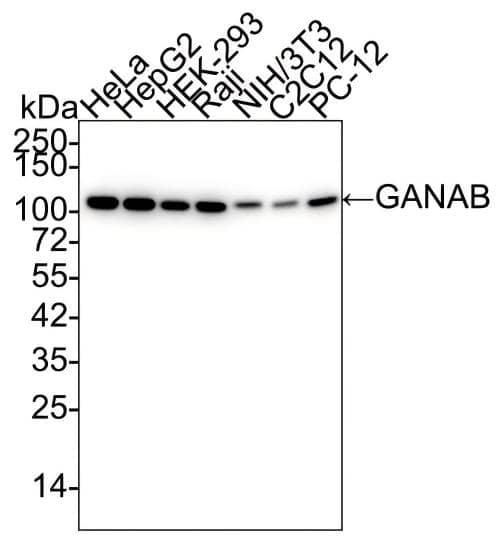 Western Blot alpha Glucosidase 2 Antibody (PSH01-52)
