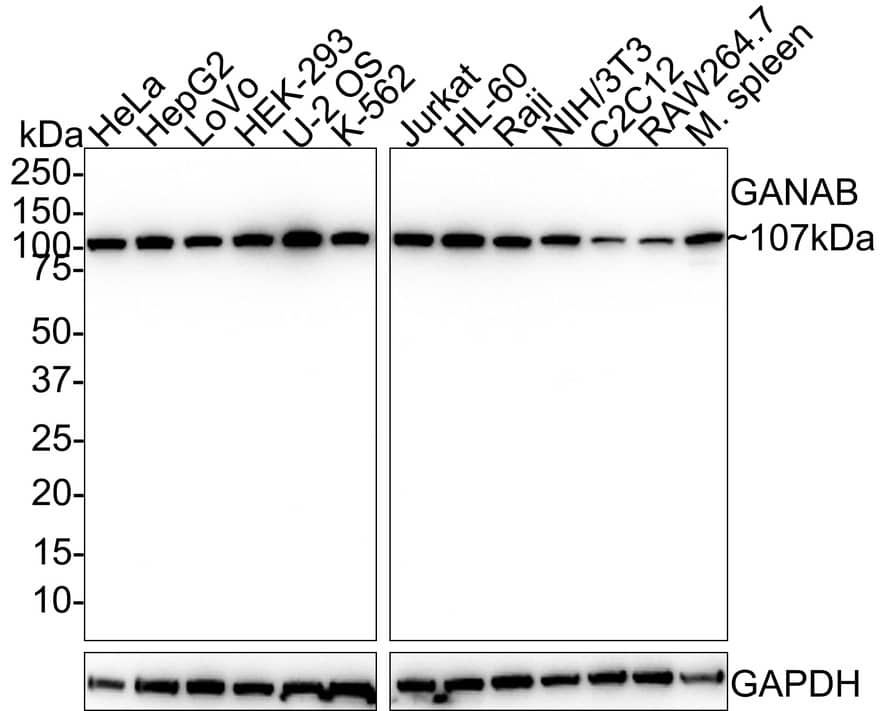 Western Blot alpha Glucosidase 2 Antibody (PSH01-52)
