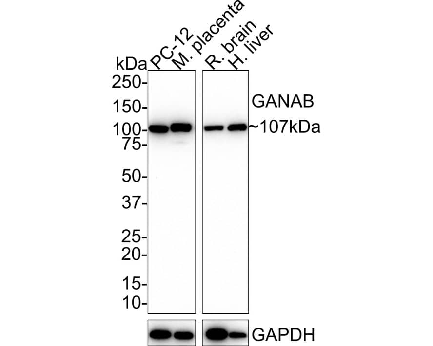 Western Blot alpha Glucosidase 2 Antibody (PSH01-52)