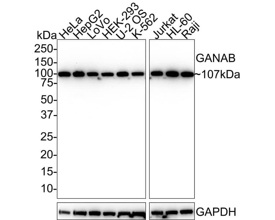 Western blot analysis on different lysates with NBP3-32367 at 1/1,000 dilution. Lane 1: HeLa cell lysate (20 µg/Lane) Lane 2: HepG2 cell lysate (20 µg/Lane) Lane 3: LoVo cell lysate (20 µg/Lane) Lane 4: HEK-293 cell lysate (20 µg/Lane) Lane 5: U-2 OS cell lysate (20 µg/Lane) Lane 6: K-562 cell lysate (20 µg/Lane) Lane 7: Jurkat cell lysate (20 µg/Lane) Lane 8: HL-60 cell lysate (20 µg/Lane) Lane 9: Raji cell lysate (20 µg/Lane) Predicted band size: 107 kDa Observed band size: 107 kDa Exposure time: 1 minute 2 seconds;  4-20% SDS-PAGE gel. Proteins were transferred to a PVDF membrane and blocked with 5% NFDM/TBST for 1 hour at room temperature. NBP3-32367 at 1/1,000 dilution was used in 5% NFDM/TBST at room temperature for 2 hours. Goat Anti-Rabbit IgG [HRP] Secondary Antibody at 1/50,000 dilution was used for 1 hour at room temperature.