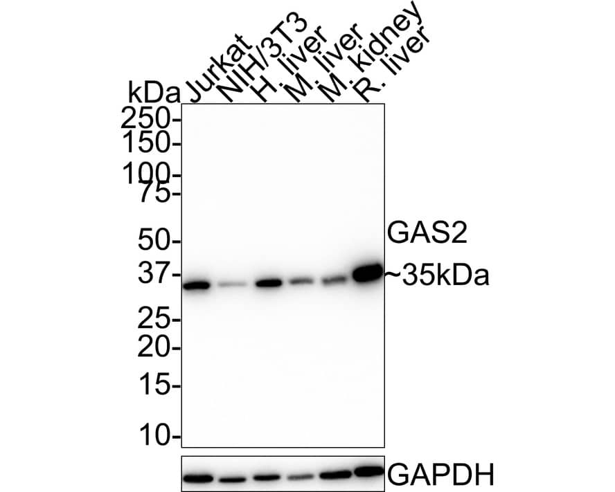 Western blot analysis on different lysates with NBP3-32368 at 1/1,000 dilution. Lane 1: Jurkat cell lysate (20 µg/Lane) Lane 2: NIH/3T3 cell lysate (20 µg/Lane) Lane 3: Human liver tissue lysate (40 µg/Lane) Lane 4: Mouse liver tissue lysate (40 µg/Lane) Lane 5: Mouse kidney tissue lysate (40 µg/Lane) Lane 6: Rat liver tissue lysate (40 µg/Lane) Predicted band size: 35 kDa Observed band size: 35 kDa Exposure time: 40 seconds; 4-20% SDS-PAGE gel. Proteins were transferred to a PVDF membrane and blocked with 5% NFDM/TBST for 1 hour at room temperature. NBP3-32368 at 1/1,000 dilution was used in 5% NFDM/TBST at room temperature for 2 hours. Goat Anti-Rabbit IgG [HRP] Secondary Antibody at 1:50,000 dilution was used for 1 hour at room temperature.