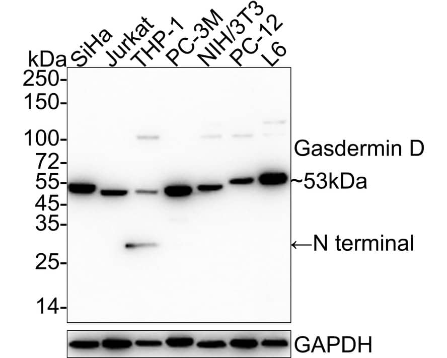 Western Blot: GSDMDC1 Antibody (PD00-18) - N-terminal [NBP3-32369] - Western blot analysis of GSDMDC1 on different lysates with Rabbit anti-GSDMDC1 antibody (NBP3-32369) at 1/1,000 dilution. Lane 1: SiHa cell lysate Lane 2: Jurkat cell lysate Lane 3: THP-1 cell lysate Lane 4: PC-3M cell lysate Lane 5: NIH/3T3 cell lysate Lane 6: PC-12 cell lysate Lane 7: L6 cell lysate Lysates/proteins at 20 ug/Lane. Predicted band size: 53/30 kDa Observed band size: 53/30 kDa Exposure time: 43 seconds; ECL; 4-20% SDS-PAGE gel. Proteins were transferred to a PVDF membrane and blocked with 5% NFDM/TBST for 1 hour at room temperature. The primary antibody (NBP3-32369) at 1/1,000 dilution was used in 5% NFDM/TBST at 4C overnight. Goat Anti-Rabbit IgG - HRP Secondary Antibody at 1/50,000 dilution was used for 1 hour at room temperature.