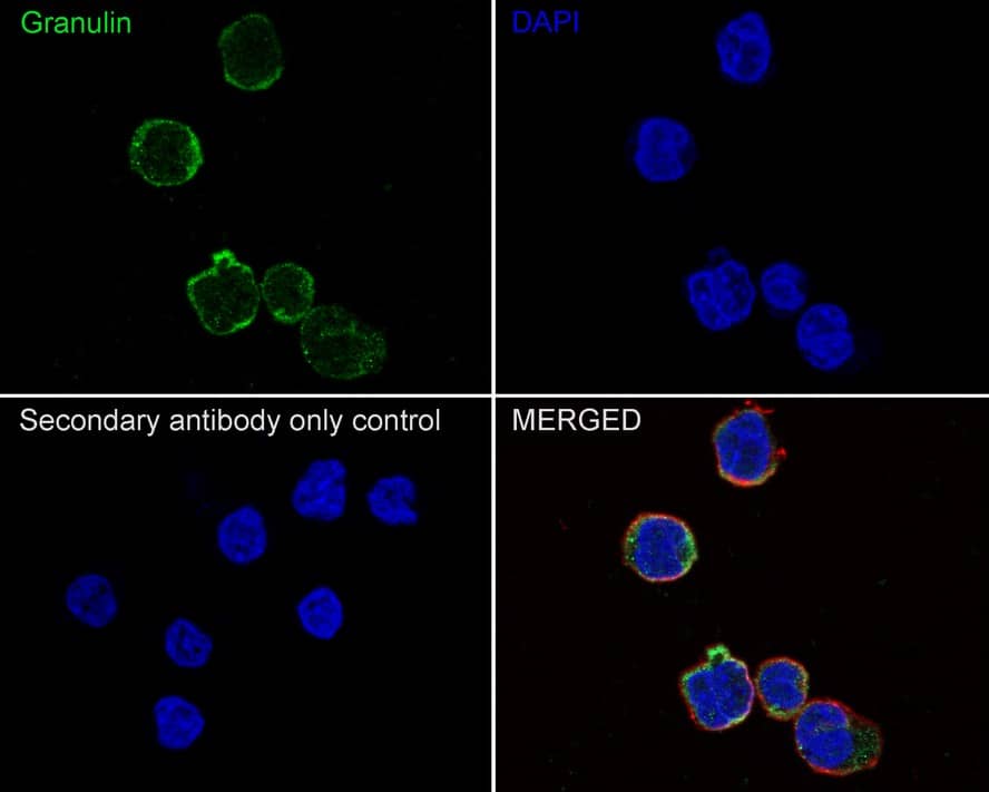 Immunocytochemistry/ Immunofluorescence: Granulin Antibody (JE37-73) [NBP3-32371] - Immunocytochemistry analysis of THP-1 cells labeling Granulin with Rabbit anti-Granulin antibody (NBP3-32371) at 1/100 dilution. Cells were fixed in 100% methanol for 10 minutes, permeabilized with 0.1% Triton X-100 in PBS for 15 minutes, and then blocked with 1% BSA for 30 minutes at room temperature. Cells were then incubated with Rabbit anti-Granulin antibody (NBP3-32371) at 1/100 dilution in 2% negative goat serum overnight at 4 ℃. Goat Anti-Rabbit IgG H&L (iFluor™ 488) was used as the secondary antibody at 1/1,000 dilution. Nuclear DNA was labelled in blue with DAPI. Beta tubulin (red) was stained at 1/100 dilution overnight at +4℃. Goat Anti-Mouse IgG H&L (iFluor™ 594) was used as the secondary antibody at 1/1,000 dilution.