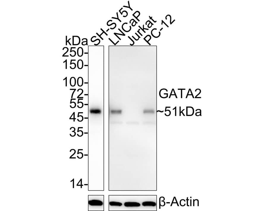 Western Blot: GATA-2 Antibody (PSH04-53) [NBP3-32373] - Western blot analysis of GATA-2 on different lysates with Rabbit anti-GATA-2 antibody (NBP3-32373) at 1/2,000 dilution. Lane 1: SH-SY5Y cell lysate Lane 2: LNCaP cell lysate Lane 3: Jurkat cell lysate (negative) Lane 4: PC-12 cell lysate Lysates/proteins at 20 ug/Lane. Predicted band size: 51 kDa Observed band size: 51 kDa Exposure time: Lane 1: 9 seconds; Lane 2-4: 40 seconds; ECL; 4-20% SDS-PAGE gel. Proteins were transferred to a PVDF membrane and blocked with 5% NFDM/TBST for 1 hour at room temperature. The primary antibody (NBP3-32373) at 1/2,000 dilution was used in 5% NFDM/TBST at 4  overnight. Goat Anti-Rabbit IgG - HRP Secondary Antibody at 1/50,000 dilution was used for 1 hour at room temperature.