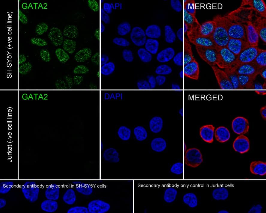 Immunocytochemistry/ Immunofluorescence: GATA-2 Antibody (PSH04-53) [NBP3-32373] - Immunocytochemistry analysis of SH-SY5Y (positive) and Jurkat (negative) labeling GATA-2 with Rabbit anti-GATA-2 antibody (NBP3-32373) at 1/100 dilution. Cells were fixed in 4% paraformaldehyde for 20 minutes at room temperature, permeabilized with 0.1% Triton X-100 in PBS for 5 minutes at room temperature, then blocked with 1% BSA in 10% negative goat serum for 1 hour at room temperature. Cells were then incubated with Rabbit anti-GATA-2 antibody (NBP3-32373) at 1/100 dilution in 1% BSA in PBST overnight at 4 ℃. Goat Anti-Rabbit IgG H&L (iFluor™ 488) was used as the secondary antibody at 1/1,000 dilution. PBS instead of the primary antibody was used as the secondary antibody only control. Nuclear DNA was labelled in blue with DAPI. Beta tubulin (red) was stained at 1/100 dilution overnight at +4℃. Goat Anti-Mouse IgG H&L (iFluor™ 594) was used as the secondary antibody at 1/1,000 dilution.