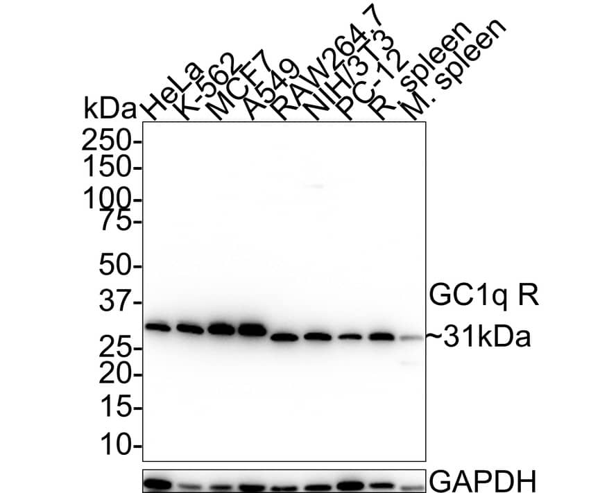 Western blot analysis on different lysates with NBP3-32376 at 1/1,000 dilution. Lane 1: HeLa cell lysate (20 µg/Lane) Lane 2: K-562 cell lysate (20 µg/Lane) Lane 3: MCF7 cell lysate (20 µg/Lane) Lane 4: A549 cell lysate (20 µg/Lane) Lane 5: RAW264.7 cell lysate (20 µg/Lane) Lane 6: NIH/3T3 cell lysate (20 µg/Lane) Lane 7: PC-12 cell lysate (20 µg/Lane) Lane 8: Rat spleen tissue lysate (40 µg/Lane) Lane 9: Mouse spleen tissue lysate (40 µg/Lane) Predicted band size: 31 kDa Observed band size: 31 kDa Exposure time: 17 seconds; 4-20% SDS-PAGE gel. Proteins were transferred to a PVDF membrane and blocked with 5% NFDM/TBST for 1 hour at room temperature. NBP3-32376 at 1/1,000 dilution was used in 5% NFDM/TBST at 4℃ overnight. Goat anti-Mouse IgG [HRP] at 1/50,000 dilution was used for 1 hour at room temperature.