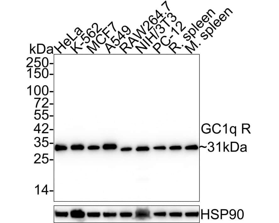 Western blot analysis on different lysates with NBP3-32377 at 1/1,000 dilution. Lane 1: HeLa cell lysate (20 µg/Lane) Lane 2: K-562 cell lysate (20 µg/Lane) Lane 3: MCF7 cell lysate (20 µg/Lane) Lane 4: A549 cell lysate (20 µg/Lane) Lane 5: RAW264.7 cell lysate (20 µg/Lane) Lane 6: NIH/3T3 cell lysate (20 µg/Lane) Lane 7: PC-12 cell lysate (20 µg/Lane) Lane 8: Rat spleen tissue lysate (40 µg/Lane) Lane 9: Mouse spleen tissue lysate (40 µg/Lane) Predicted band size: 31 kDa Observed band size: 31 kDa Exposure time: 24 seconds; 4-20% SDS-PAGE gel. Proteins were transferred to a PVDF membrane and blocked with 5% NFDM/TBST for 1 hour at room temperature. NBP3-32377 at 1/1,000 dilution was used in 5% NFDM/TBST at 4℃ overnight. Goat anti-Mouse IgG [HRP] at 1/50,000 dilution was used for 1 hour at room temperature.