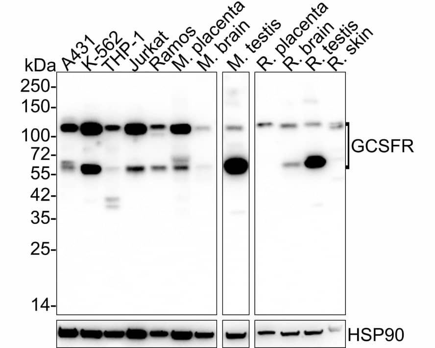 Western Blot: G-CSFR/CD114 Antibody (PSH03-44) [NBP3-32378] - Western blot analysis of G-CSFR/CD114 on different lysates with Rabbit anti-G-CSFR/CD114 antibody (NBP3-32378) at 1/2,000 dilution. Lane 1: A431 cell lysate (20 ug/Lane) Lane 2: K-562 cell lysate (20 ug/Lane) Lane 3: THP-1 cell lysate (no heat) (20 ug/Lane) Lane 4: Jurkat cell lysate (20 ug/Lane) Lane 5: Ramos cell lysate (20 ug/Lane) Lane 6: Mouse placenta tissue lysate (40 ug/Lane) Lane 7: Mouse brain tissue lysate (no heat) (40 ug/Lane) Lane 8: Mouse testis tissue lysate (40 ug/Lane) Lane 9: Rat placenta tissue lysate (40 ug/Lane) Lane 10: Rat brain tissue lysate (no heat) (40 ug/Lane) Lane 11: Rat testis tissue lysate (40 ug/Lane) Lane 12: Rat skin tissue lysate (no heat) (40 ug/Lane) Predicted band size: 92 kDa Observed band size: 50-110 kDa Exposure time: 1 minute 40 seconds; 4-20% SDS-PAGE gel. Proteins were transferred to a PVDF membrane and blocked with 5% NFDM/TBST for 1 hour at room temperature. The primary antibody (NBP3-32378) at 1/2,000 dilution was used in 5% NFDM/TBST at 4  overnight. Goat Anti-Rabbit IgG - HRP Secondary Antibody at 1/50,000 dilution was used for 1 hour at room temperature.