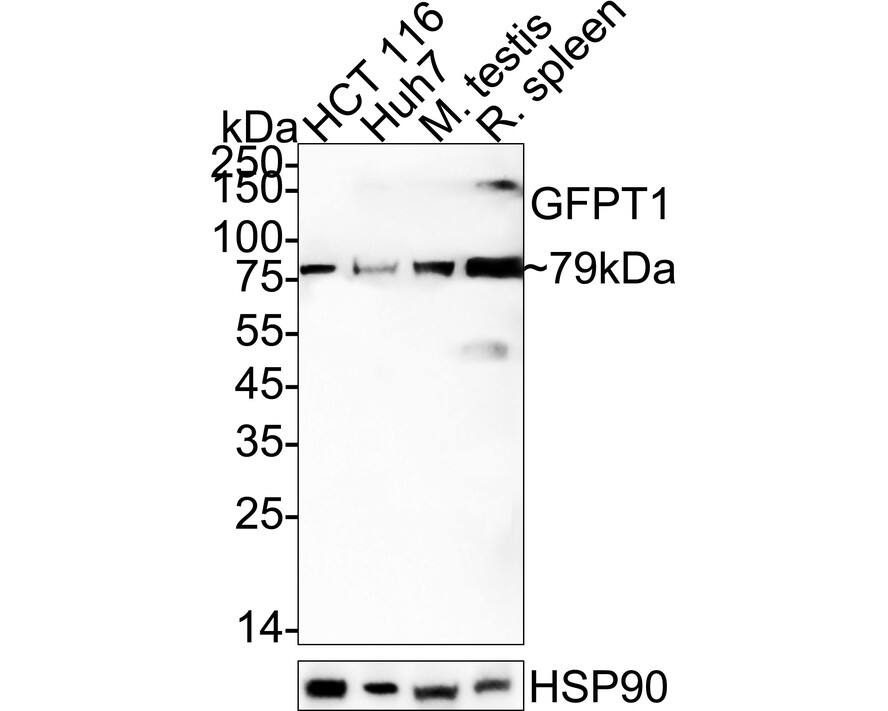 Western Blot GFPT1 Antibody (JE43-68)
