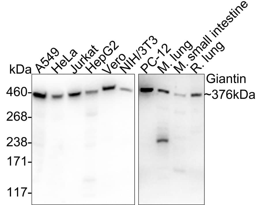 Western Blot: GOLGB1/Giantin Antibody (PSH03-86) [NBP3-32381] - Western blot analysis of GOLGB1/Giantin on different lysates with Rabbit anti-GOLGB1/Giantin antibody (NBP3-32381) at 1/1,000 dilution. Lane 1: A549 cell lysate (20 ug/Lane) Lane 2: HeLa cell lysate (20 ug/Lane) Lane 3: Jurkat cell lysate (20 ug/Lane) Lane 4: HepG2 cell lysate (20 ug/Lane) Lane 5: Vero cell lysate (20 ug/Lane) Lane 6: NIH/3T3 cell lysate (20 ug/Lane) Lane 7: PC-12 cell lysate (20 ug/Lane) Lane 8: Mouse lung tissue lysate (40 ug/Lane) Lane 9: Mouse small intestine tissue lysate (40 ug/Lane) Lane 10: Rat lung tissue lysate (40 ug/Lane) Predicted band size: 376 kDa Observed band size: 376 kDa Exposure time: Lane 1-6: 5 seconds; Lane 7-10: 1 minute 2 seconds; 3-8% SDS-PAGE gel. Proteins were transferred to a PVDF membrane and blocked with 5% NFDM/TBST for 1 hour at room temperature. The primary antibody (NBP3-32381) at 1/1,000 dilution was used in 5% NFDM/TBST at 4  overnight. Goat Anti-Rabbit IgG - HRP Secondary Antibody at 1/50,000 dilution was used for 1 hour at room temperature.